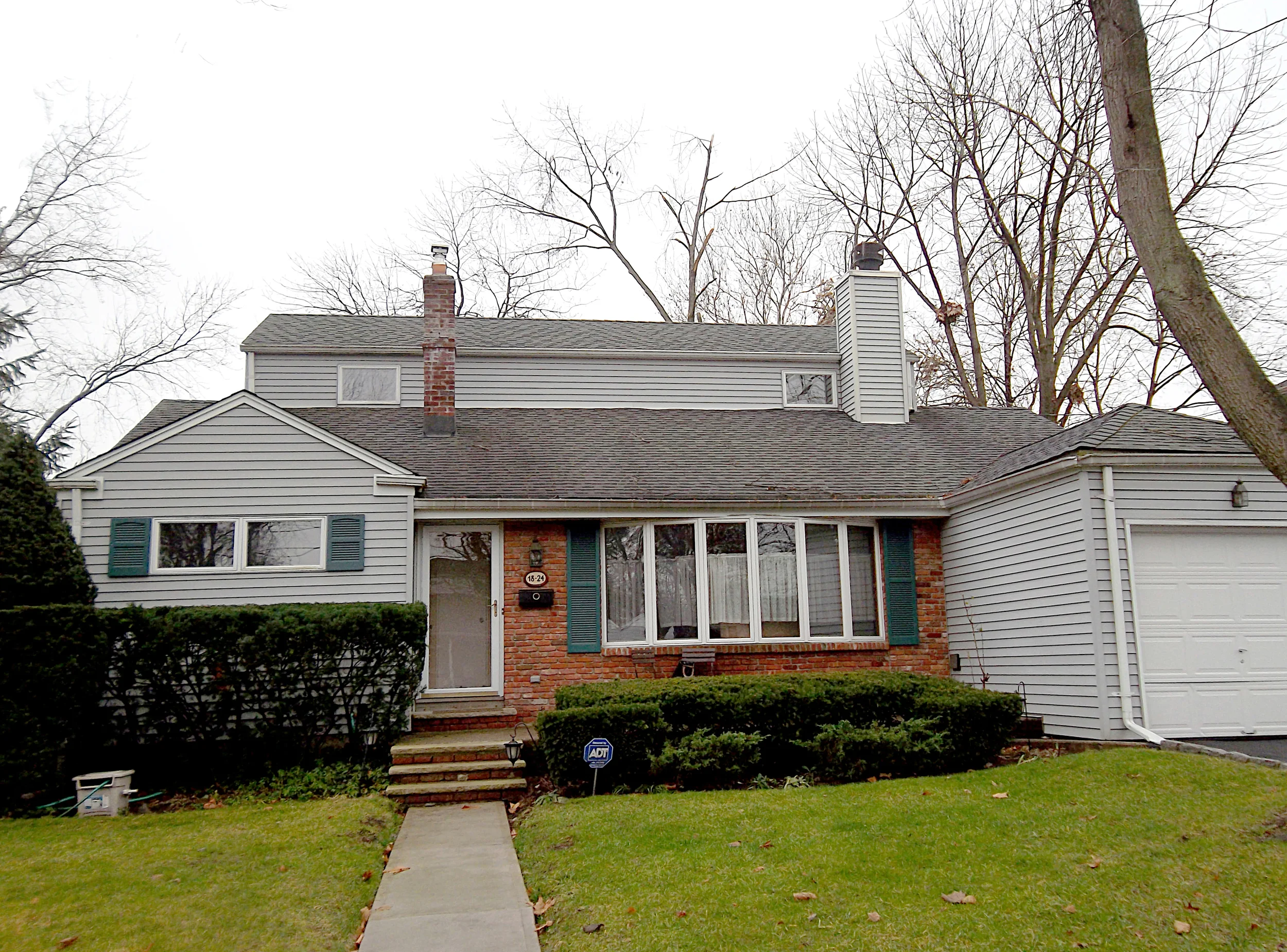  Front View, Before    