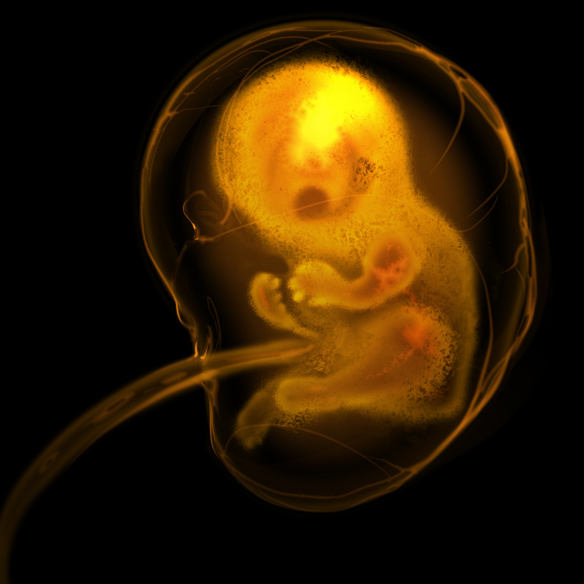 "Fetus"