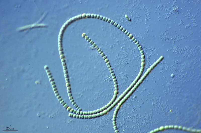 Some species of anabaena , a type of filamentous cyanobacteria, can be highly toxic . (Image by Proyecto Agua via Flickr )
