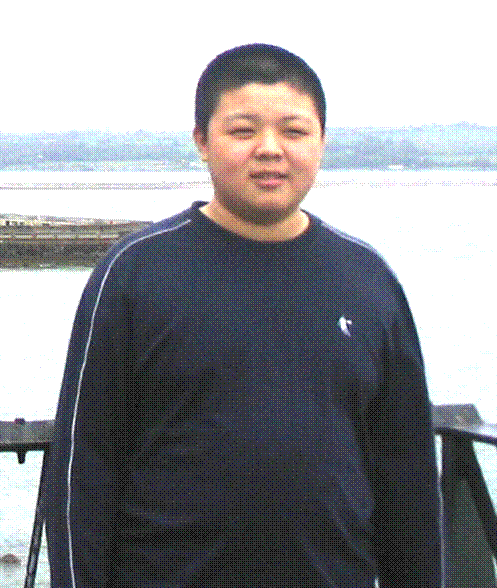 Before acupuncture weight loss program.gif