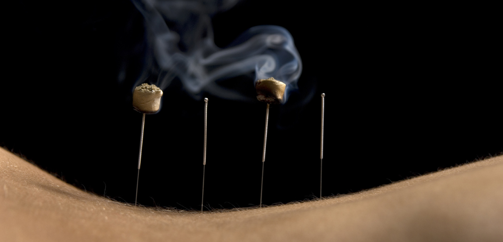 moxibustion.jpg