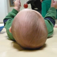 baby head flat spot one side