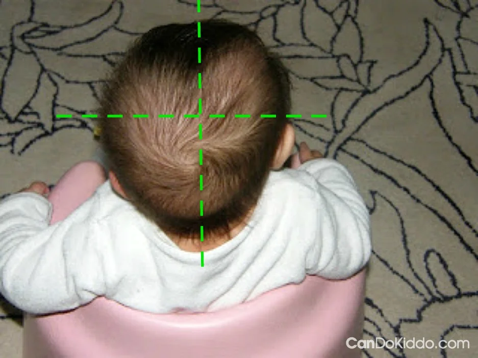 Positional Plagiocephaly Is my baby's head flat? — CanDo Kiddo