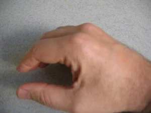 Resting hand posture