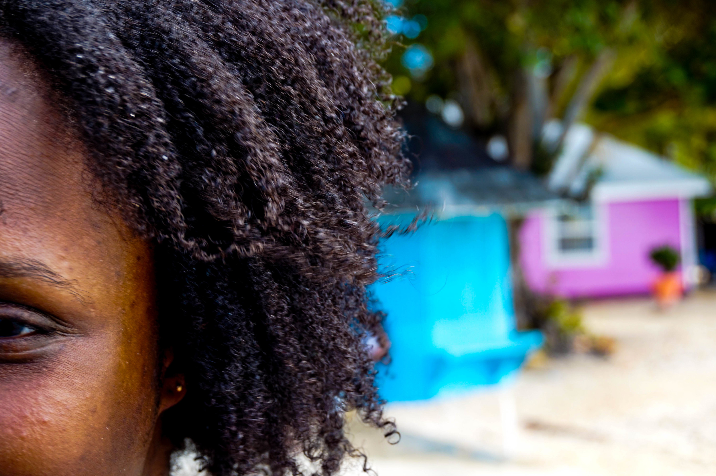 Contact dermatitis from new natural skincare product.