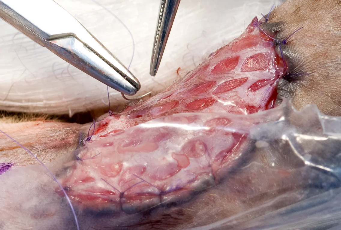 Skin Graft Procedure