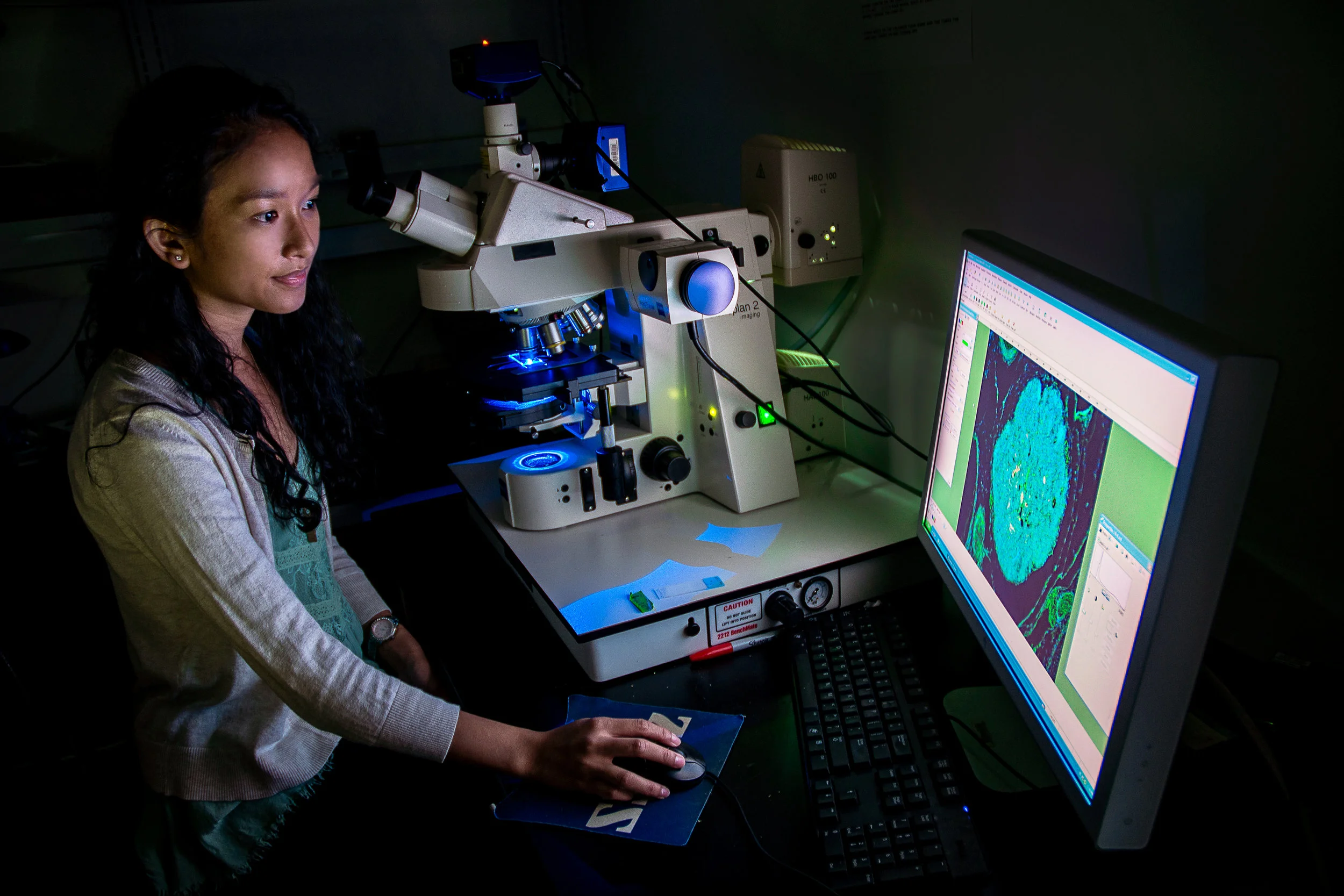 Fluorescence Microscopy in Infectious Disease Lab