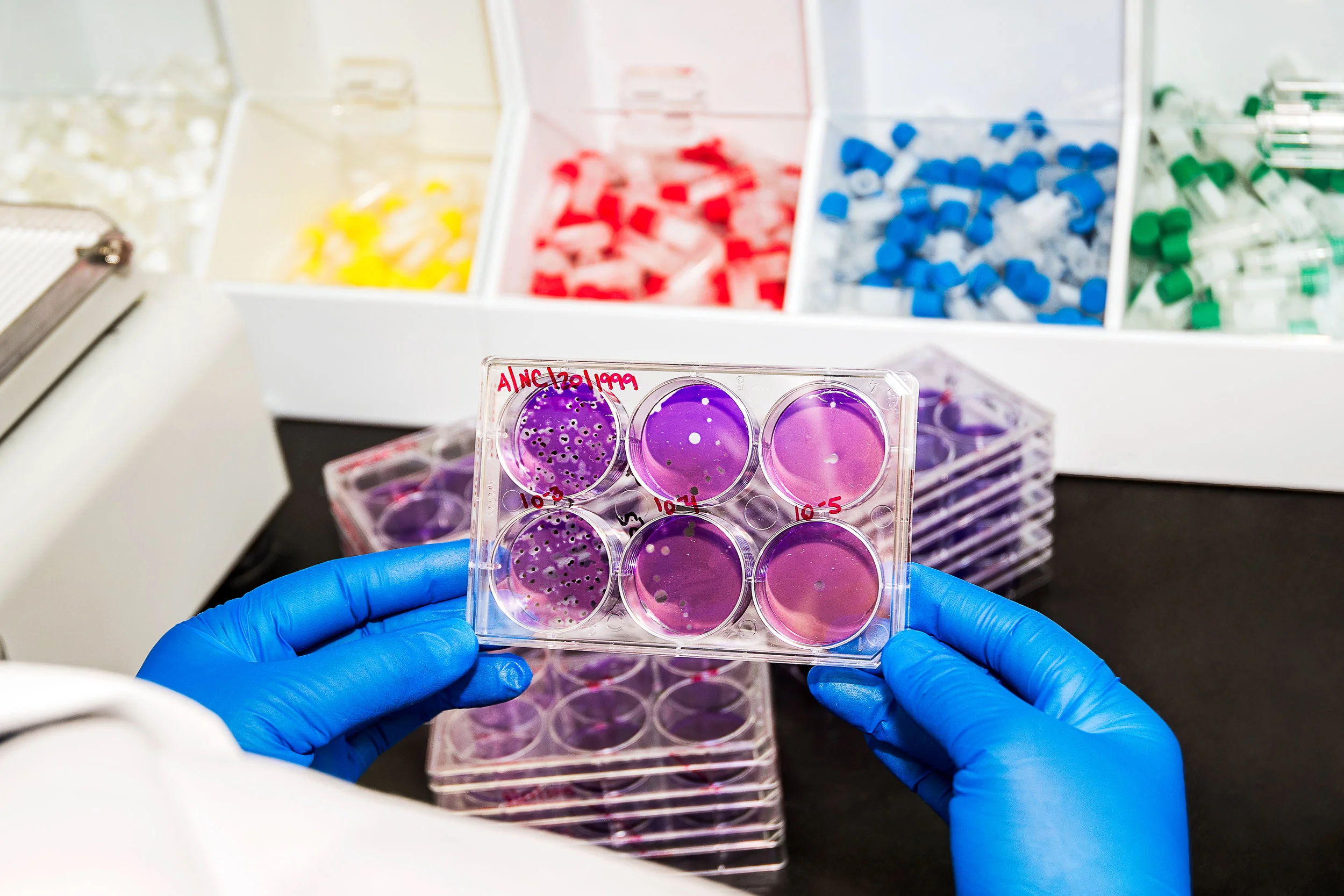 Reviewing Plates in an Infectious Disease Lab