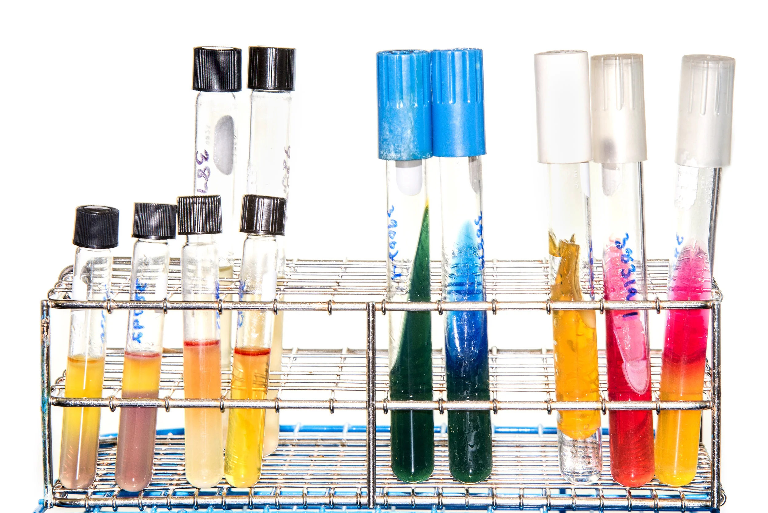 Diagnostic Lab Test Tubes