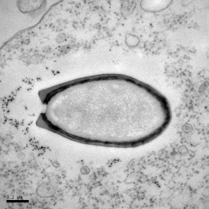 Pandoravirus infecting an amobea. ( Jean-Michel Claverie and Chantal Abergel)