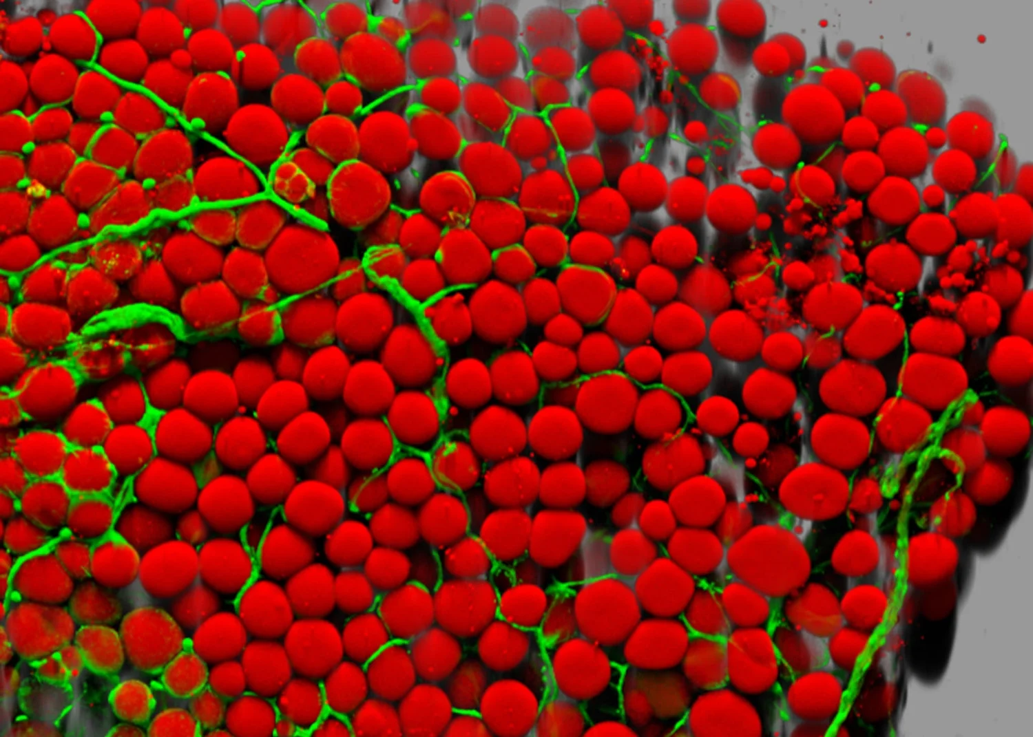 The Future of Type 2 Diabetes Treatment