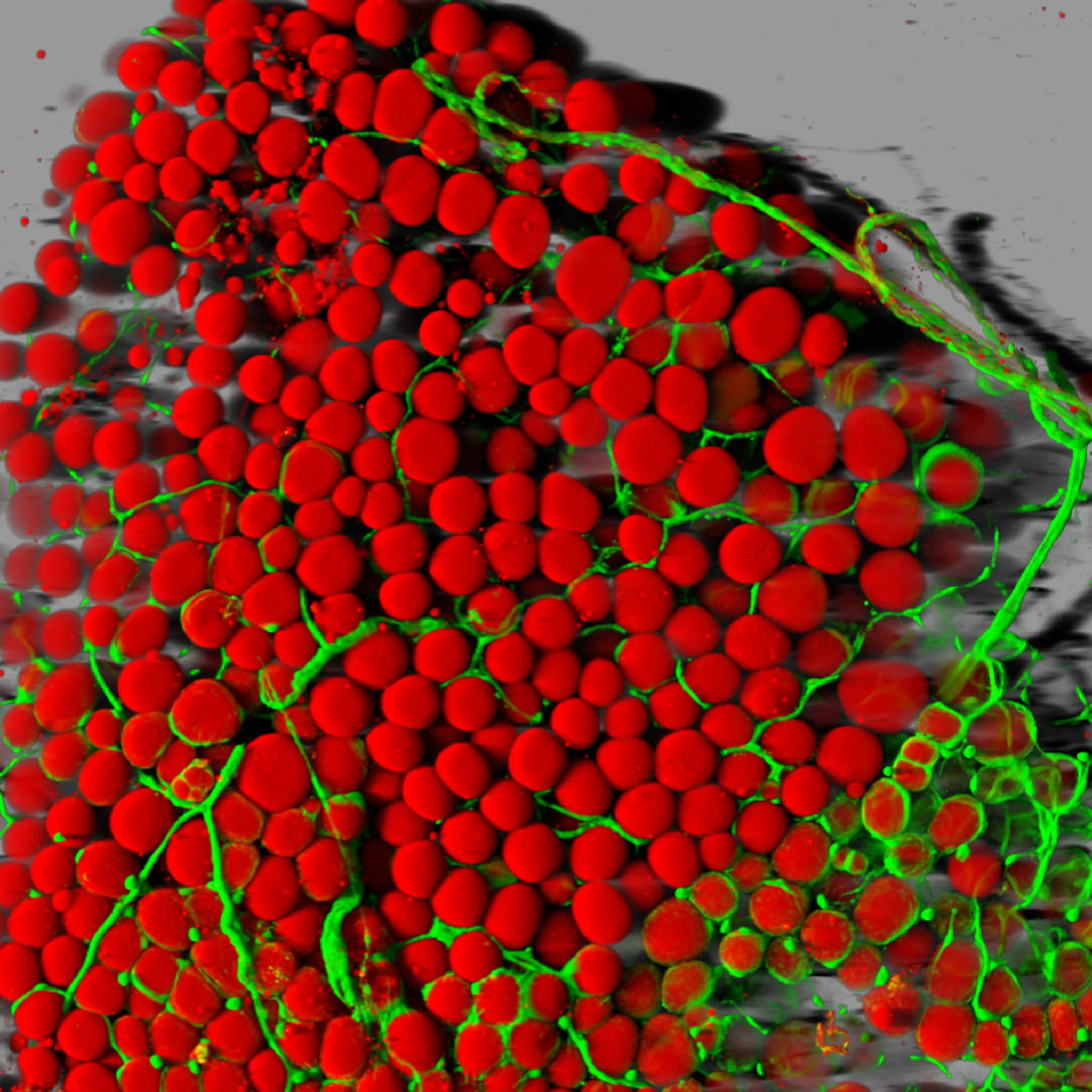The Future Of Type 2 Diabetes Treatment The PhDISH The Future Of Type 2 Diabetes Treatment The PhDISH
