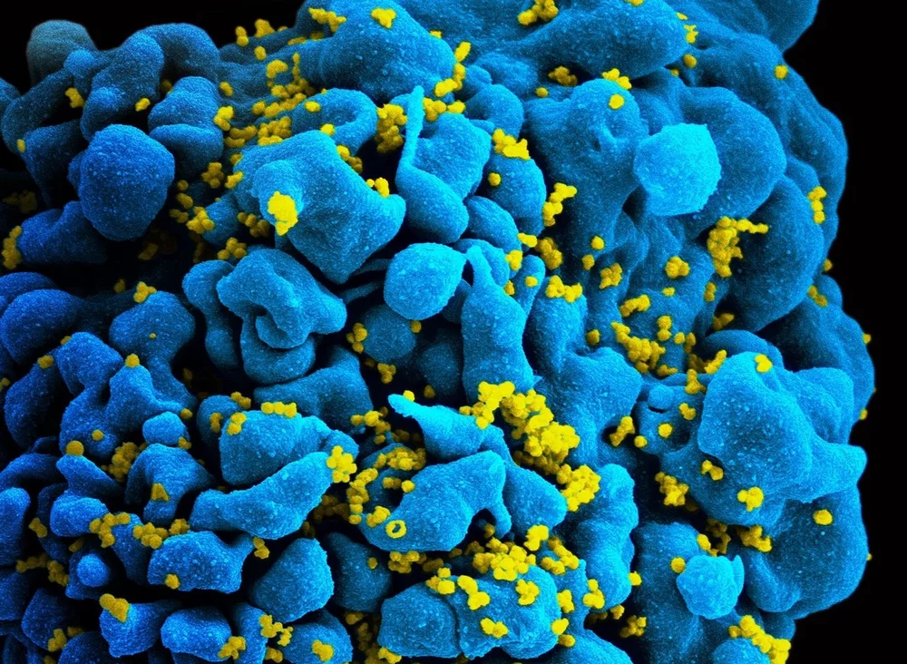 Curing humans of HIV: Is vectored immunoprophylaxis the answer? — The ...
