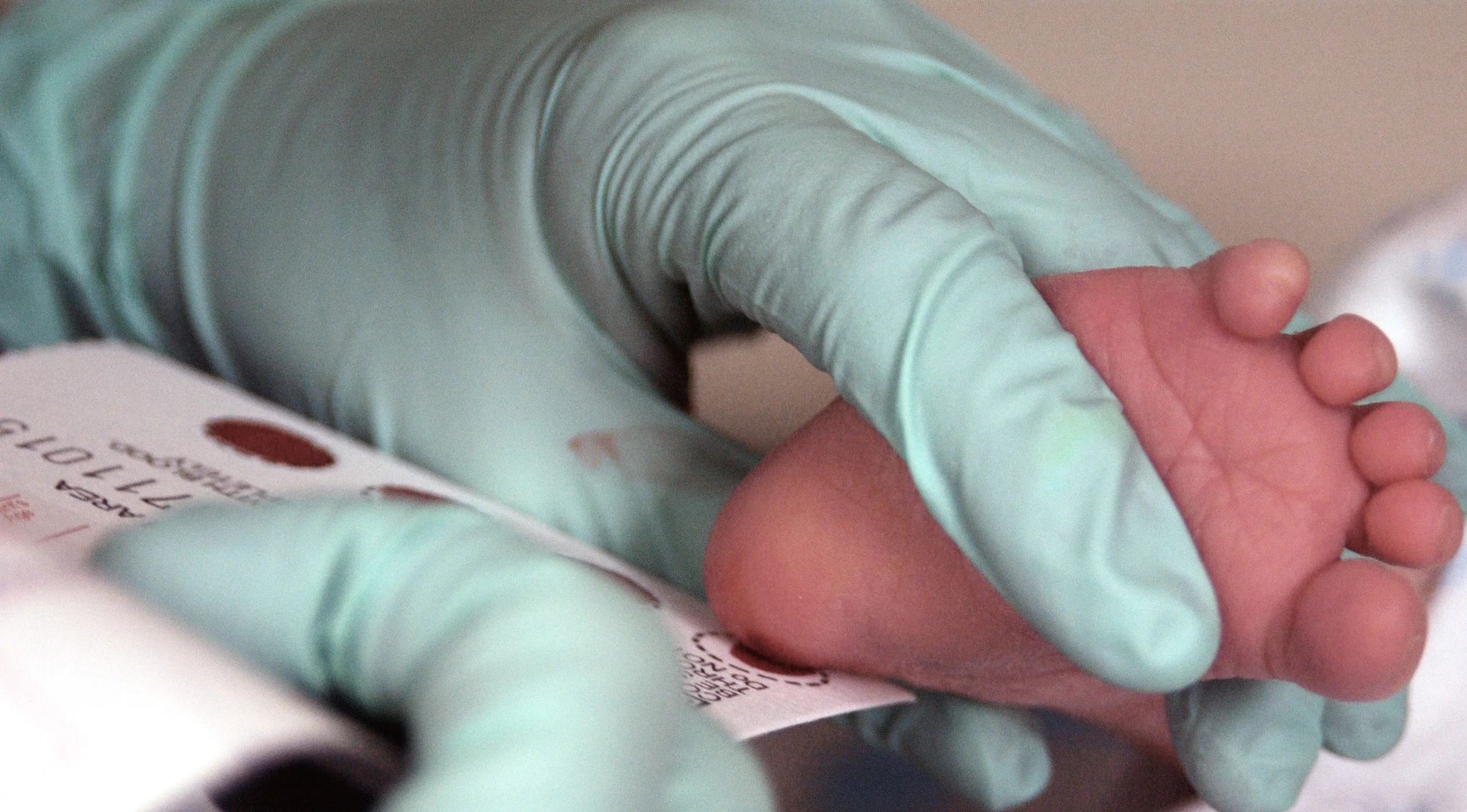 Testing a newborn for phenylketonuria. Photo: Wikipedia