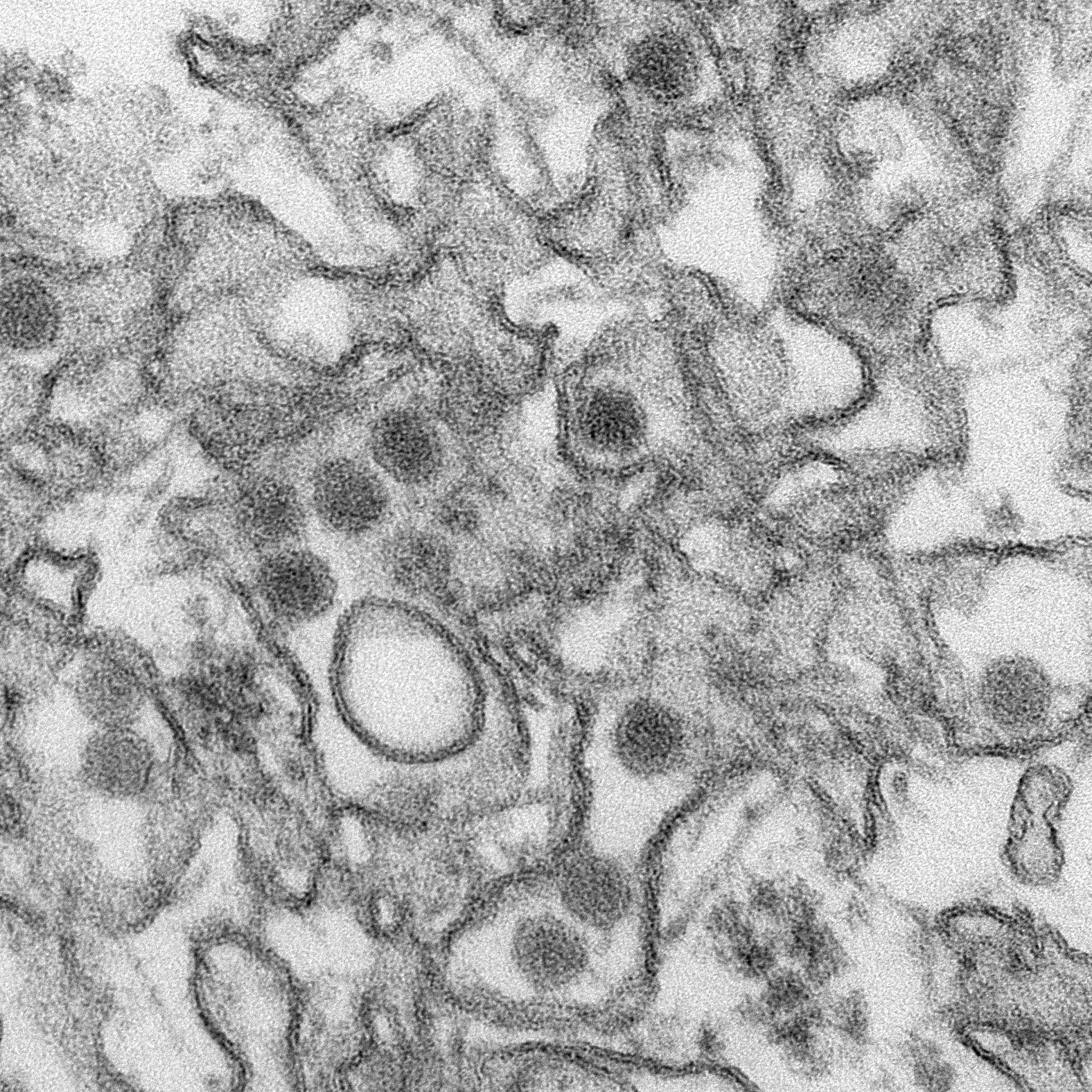 This is a transmission electron micrograph (TEM) of Zika virus, which is a member of the family Flaviviridae. Virus particles are 40 nm in diameter, with an outer envelope, and an inner dense core. (CDC / Cynthia Goldsmith)