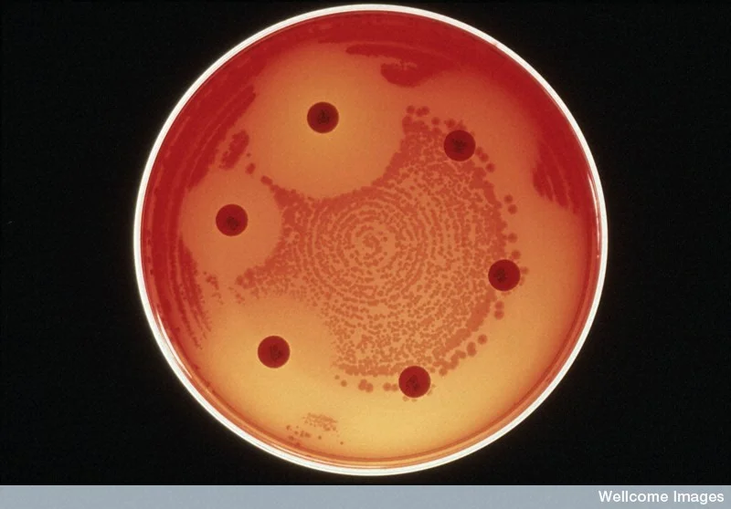 Differing levels of drug resistance in bacteria. Antibiotics (large pills) can inhibit the growth of bacteria (small dots) to varying degrees. Bacteria that can grow right next to the antibiotic pills are resistant to that antibiotic.