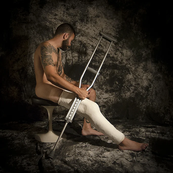 MikeCrutches.jpg