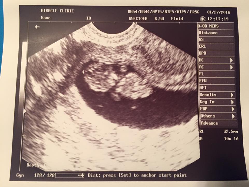 Growing baby # 2