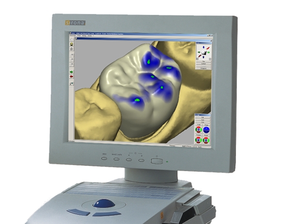 A CEREC 3D image