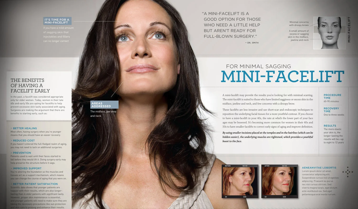  Marketing Customizable Booklet Series / Cosmetic Enhancement for &nbsp;The Face 