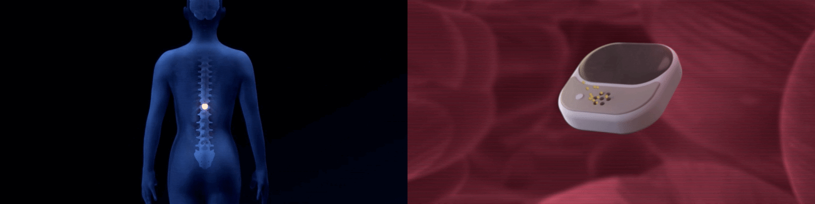 spine_and_device_2.gif