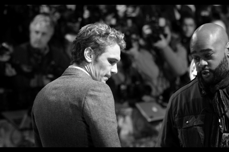 "I don't think that's dandruff sir. And to be fair, you're James Franco, so I don't think the ladies would mind"