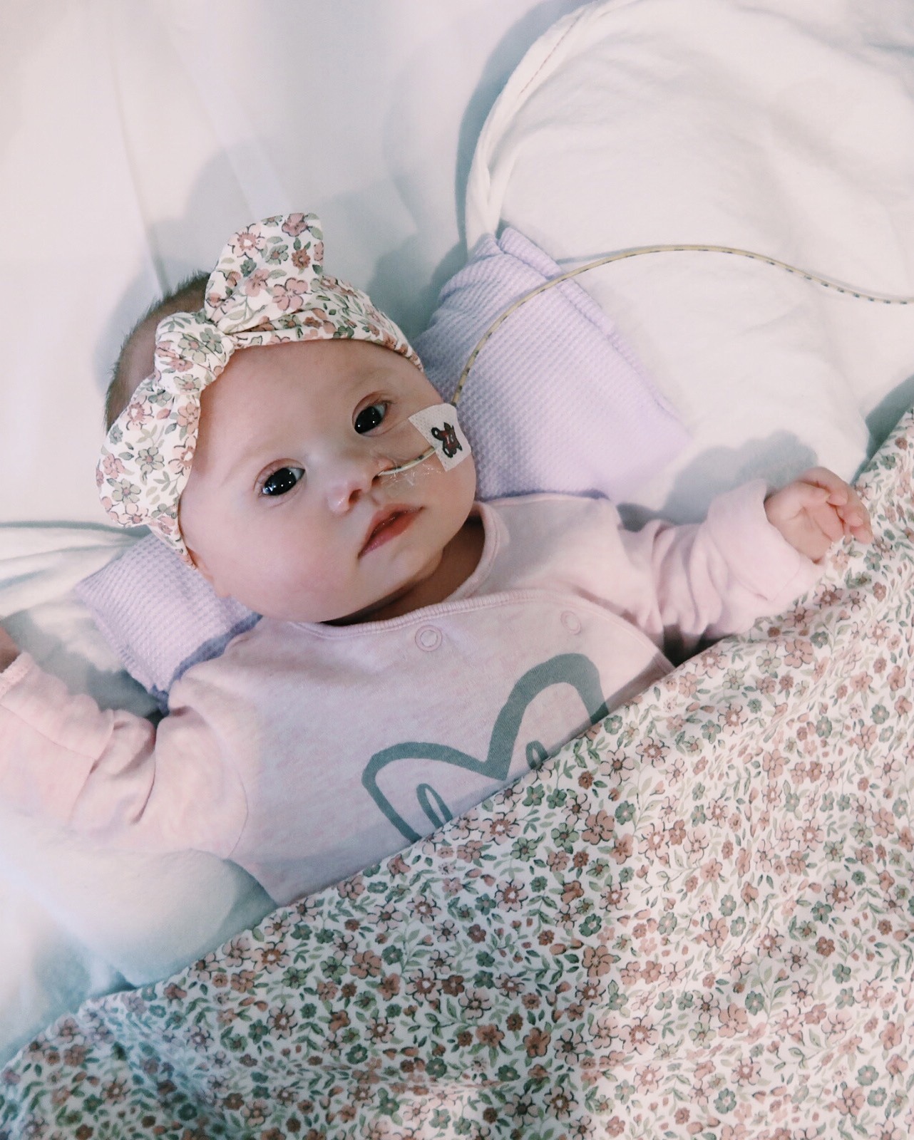 One week post surgery and Polly is looking better everyday!