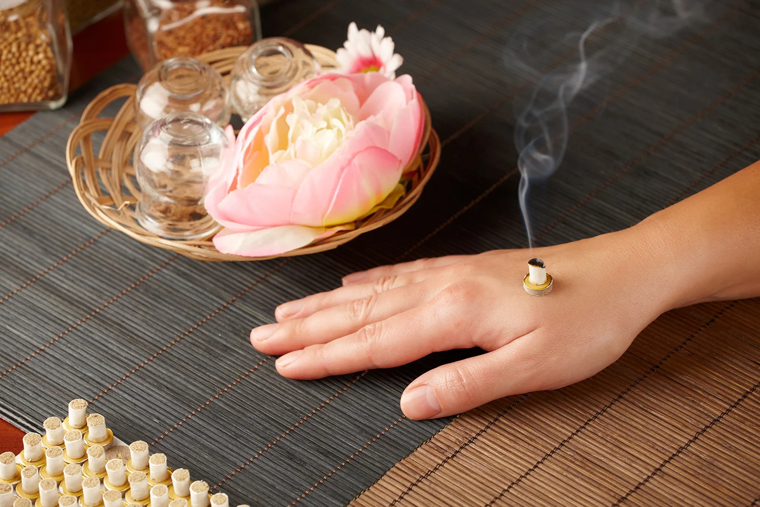 Moxibustion treatment