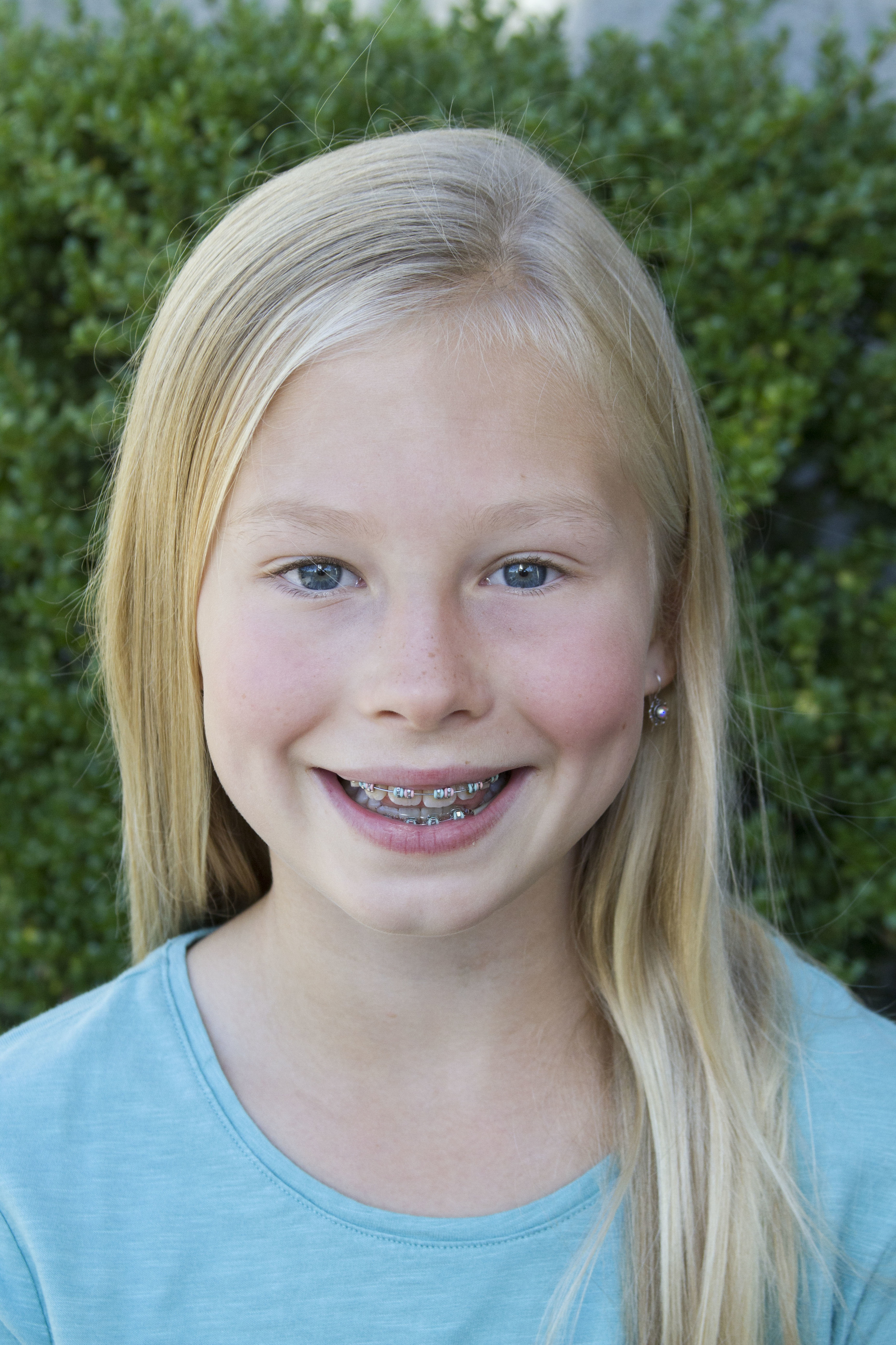 Allison Berg, Junior Dancer