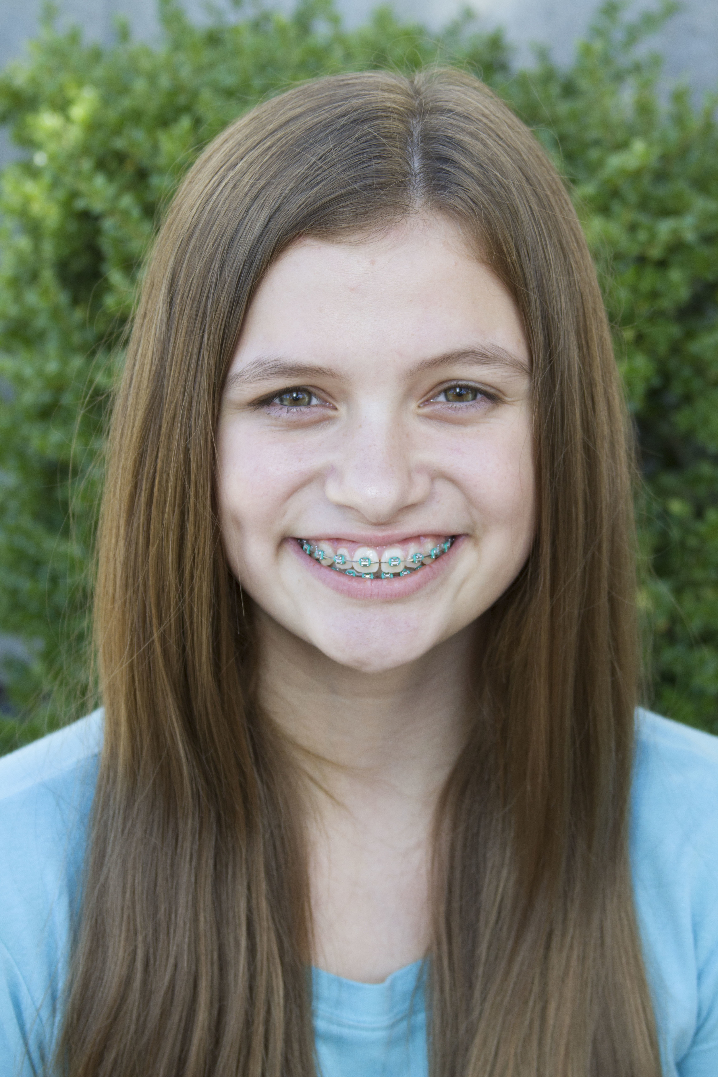 Jackie Peterson, Teen Dancer