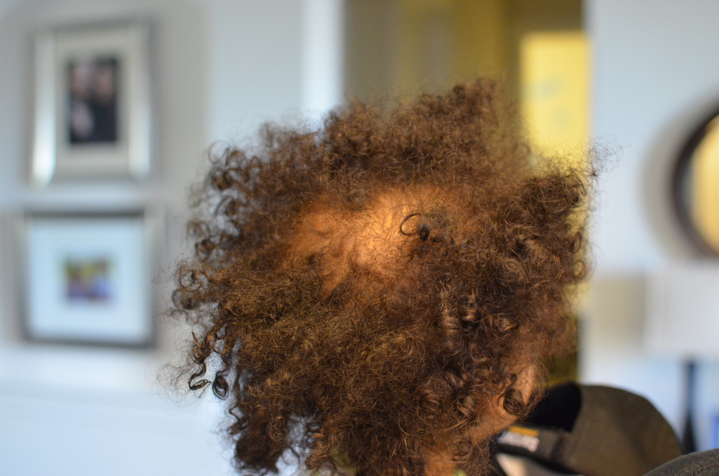 Day 26: Still has a lot of hair, but it's definitely falling out. 