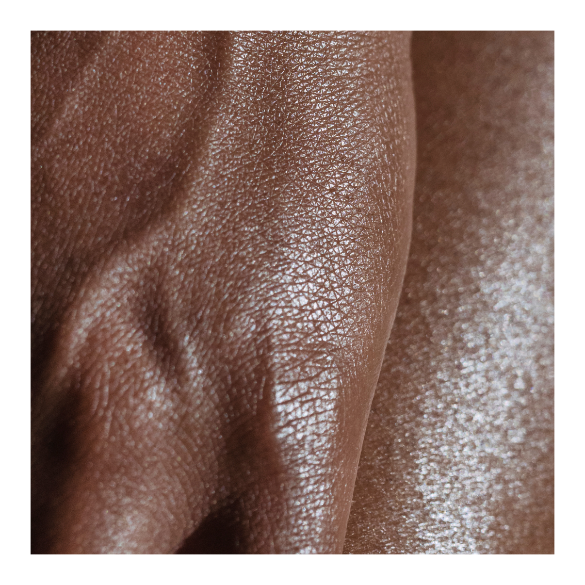 Close up of skin, showing texture