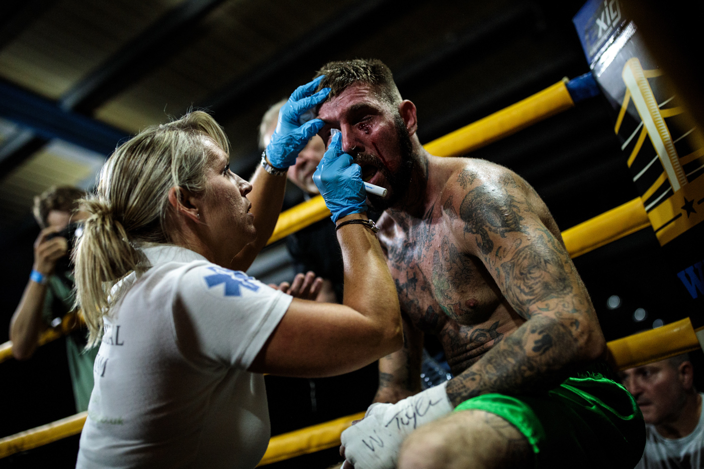 MANCHESTER, ENGLAND: Jay 'BamBam' Eggleston, 35 from Sheffield is treated by medical staff during an Ultimate Bare Knuckle Boxing (UBKB) fight at Bowlers Exhibition Centre on August 4, 2018.