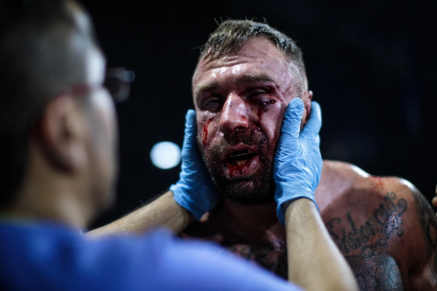 MANCHESTER, ENGLAND: Two-time World Bare-Knuckle Boxing Champion Luke Atkin, age 30 from York, is inspected by medical staff after his fight with Dom Clark during the title fight at an Ultimate Bare Knuckle Boxing (UBKB) event at Bowlers Exhibition Centre on August 4, 2018.