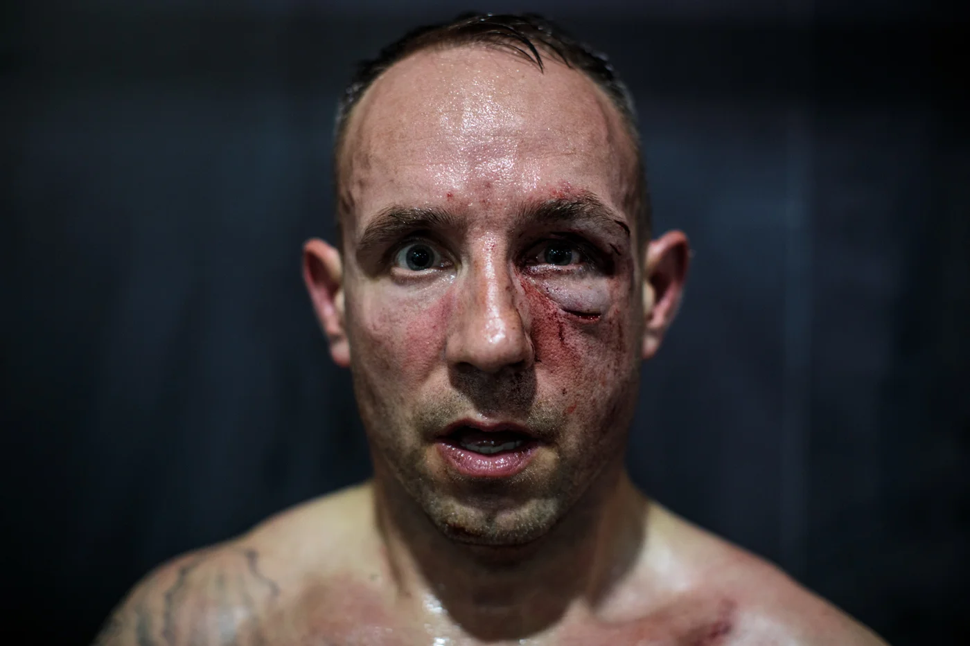 MANCHESTER, ENGLAND: Bare-knuckle boxer Paul Stredder, 35 from the Wirral, poses for a photo after his fight at an Ultimate Bare-Knuckle Boxing (UBKB) event at Bowlers Exhibition Centre on August 4, 2018.