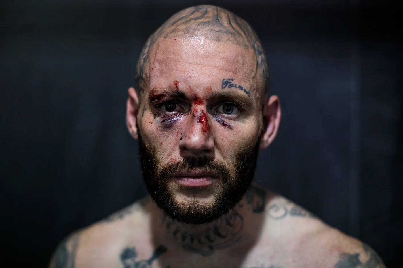 MANCHESTER, ENGLAND: Bare-knuckle boxer Chris Wheeldon, age 36 from Warrington, poses for a photo before his fight at an Ultimate Bare Knuckle Boxing (UBKB) event at Bowlers Exhibition Centre on August 4, 2018.