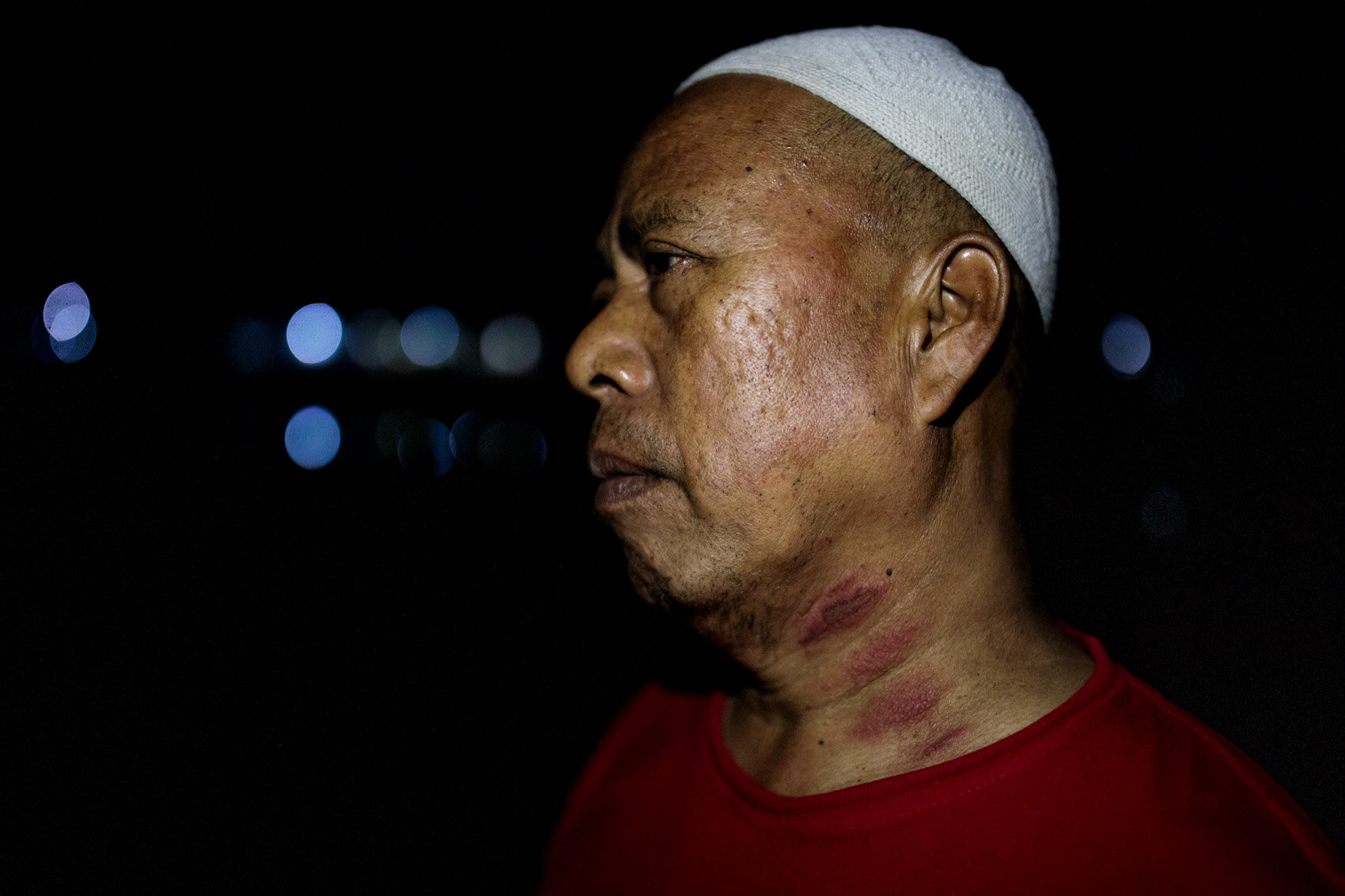  BANDUNG, INDONESIA: Security guard Dili Juanda, 55 displays his skin rashes, which he believes to be the result of the polluted water he uses for washing on November 23, 2019 in Bandung, Java, Indonesia.  