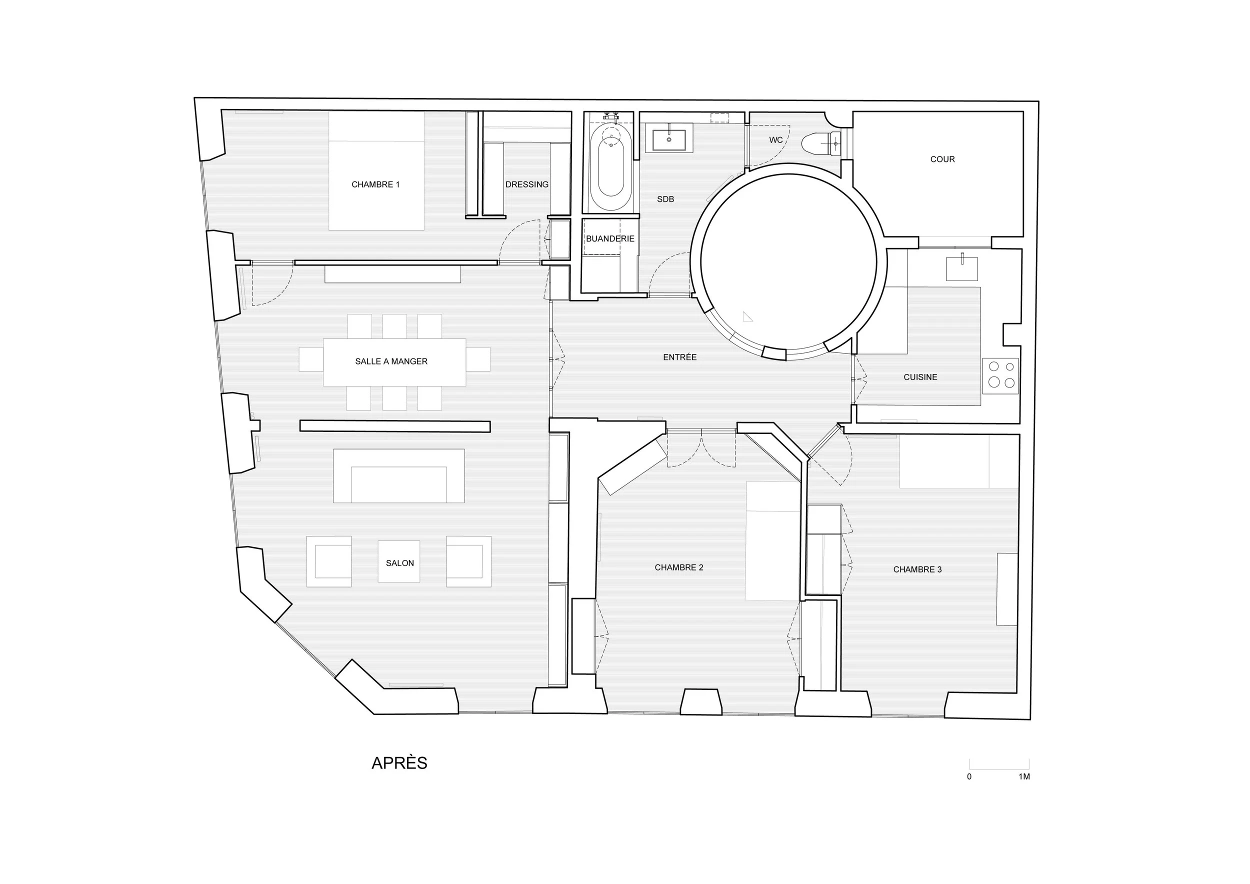 CAMILLEFLAMMARION-AVANT APRES-OPERA 2.jpg