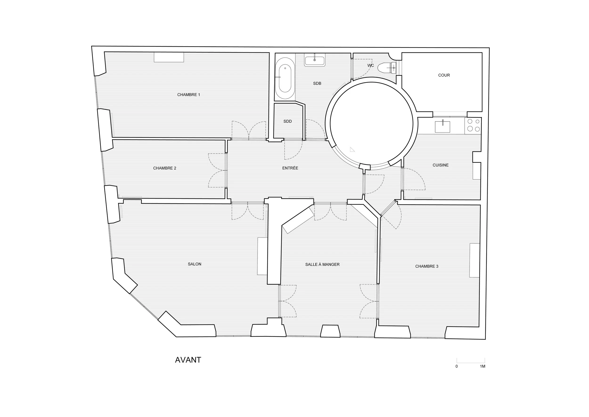 CAMILLEFLAMMARION-AVANT APRES-OPERA .jpg