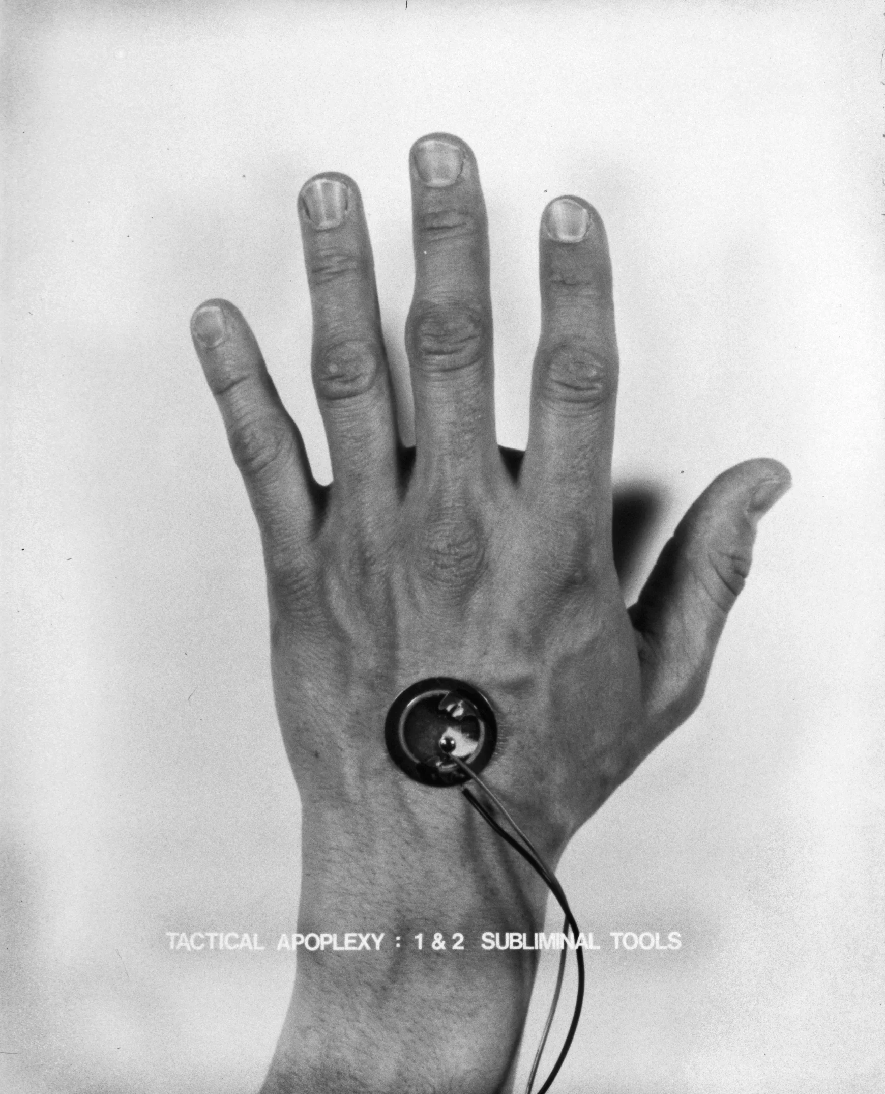 Implant