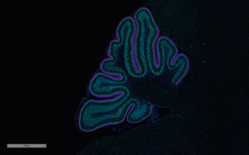 Mouse cerebellum stained with PCNA to show proliferating cells (purple) and p27 for differentiating cells (green) at height of cerebellar proliferation stage, 7 days old, in a normally developing mouse. Image courtesy of Gershon Lab.