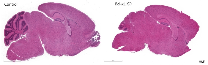 Brain sections of mice at developmental age, 20 days old. Cerebellum with deleted Bcl-xL gene sequence (right) shows increase apoptosis; control mouse with Bcl-xL intact (left). Image courtesy of Gershon Lab.