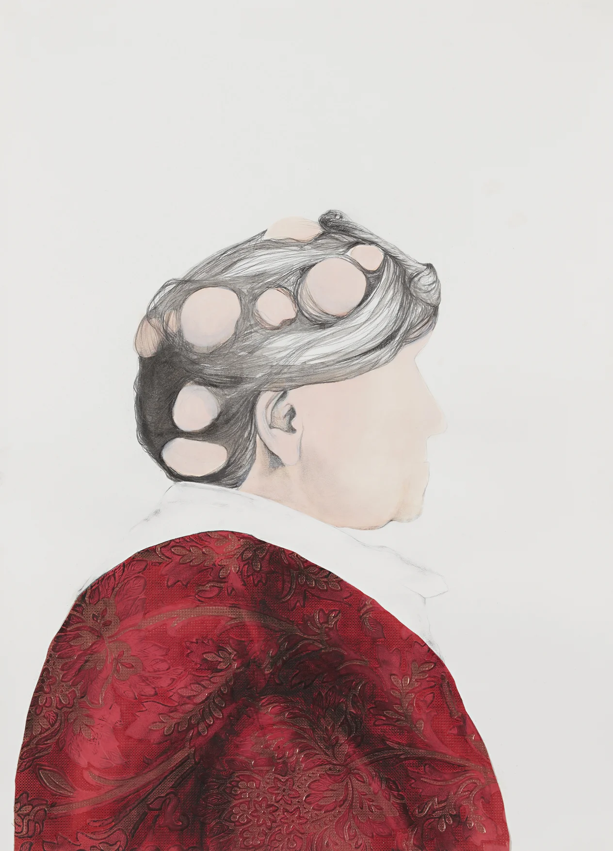 Lady with growths on head