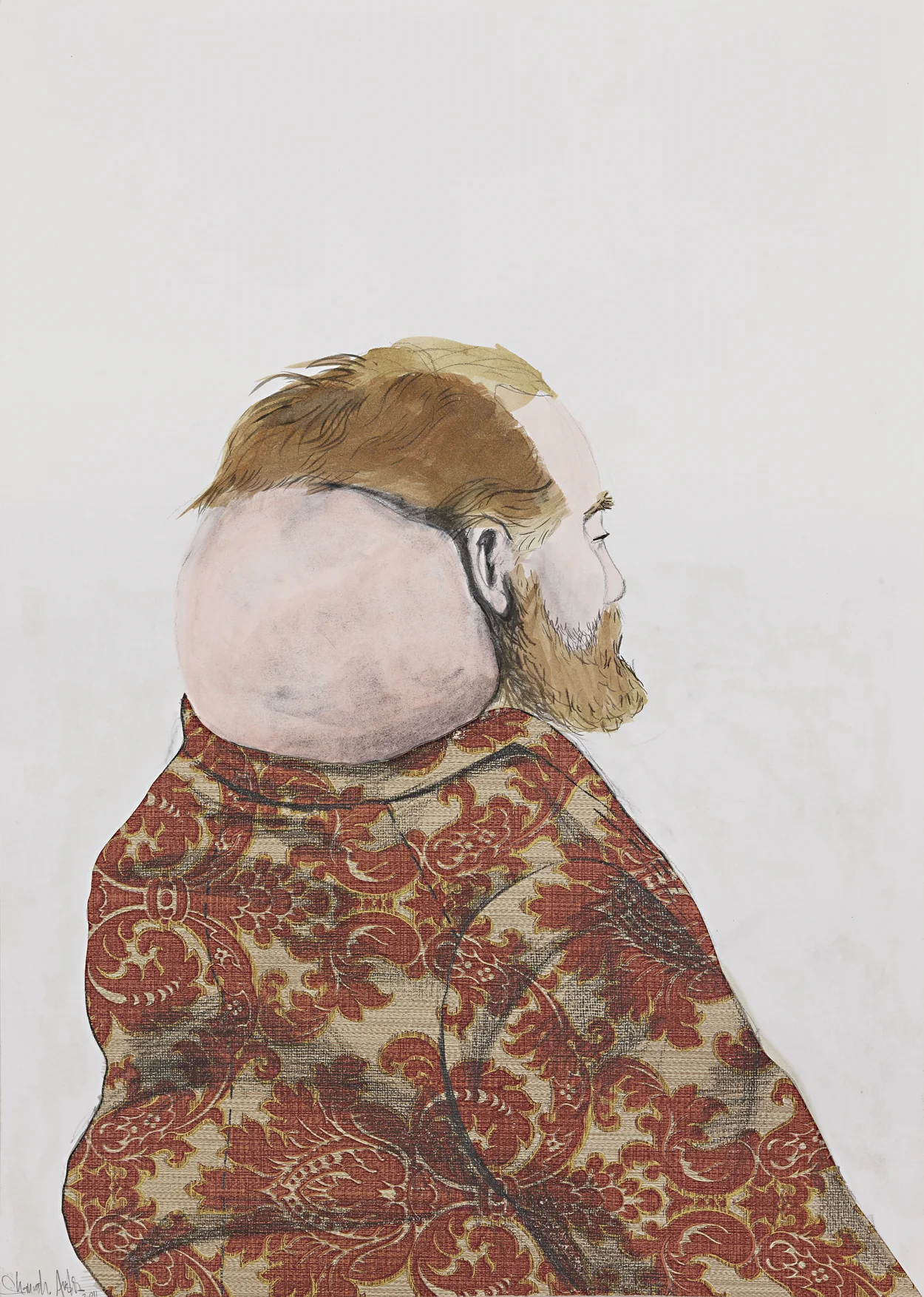 Man with tumor