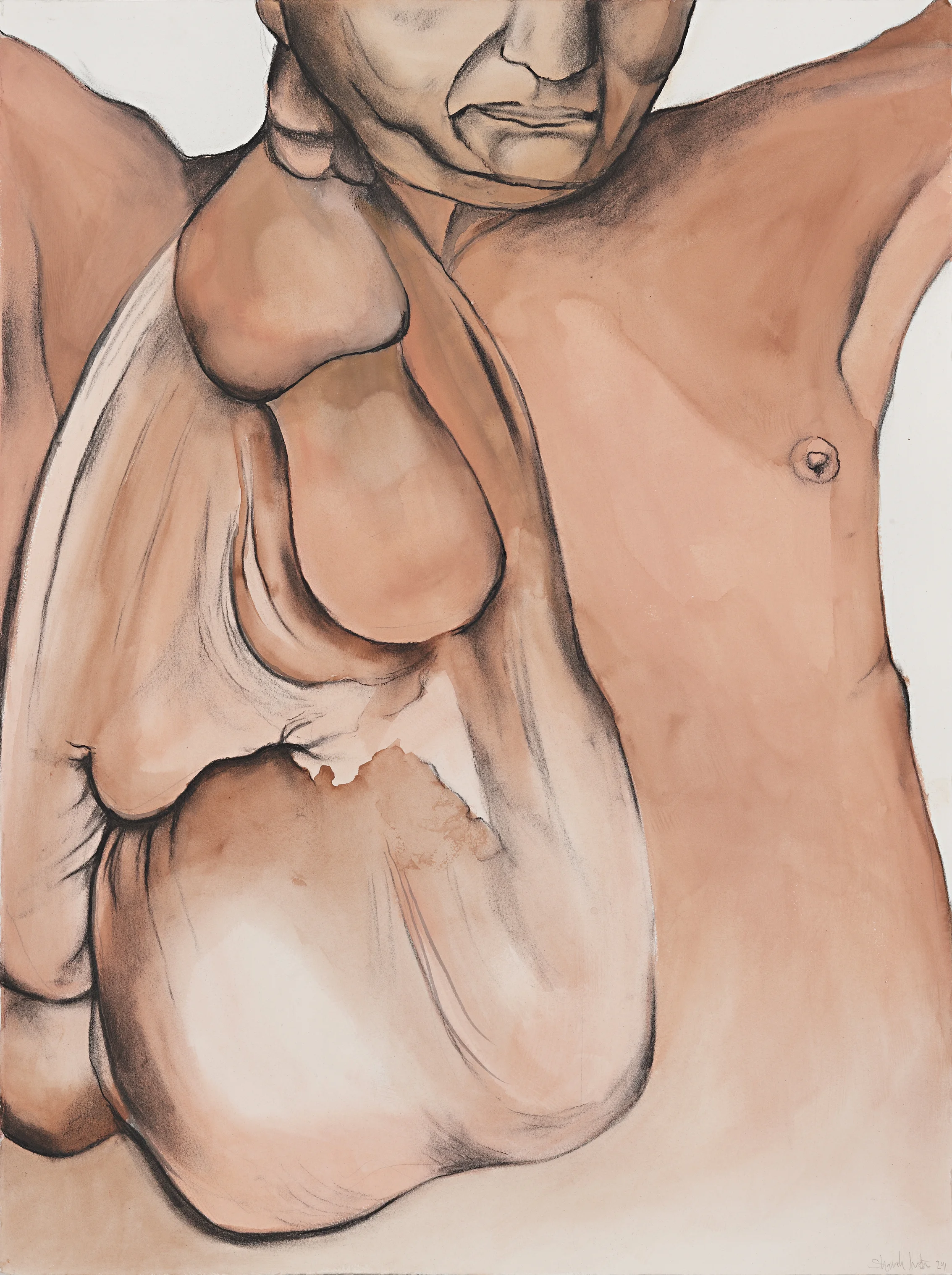 man with neck growth