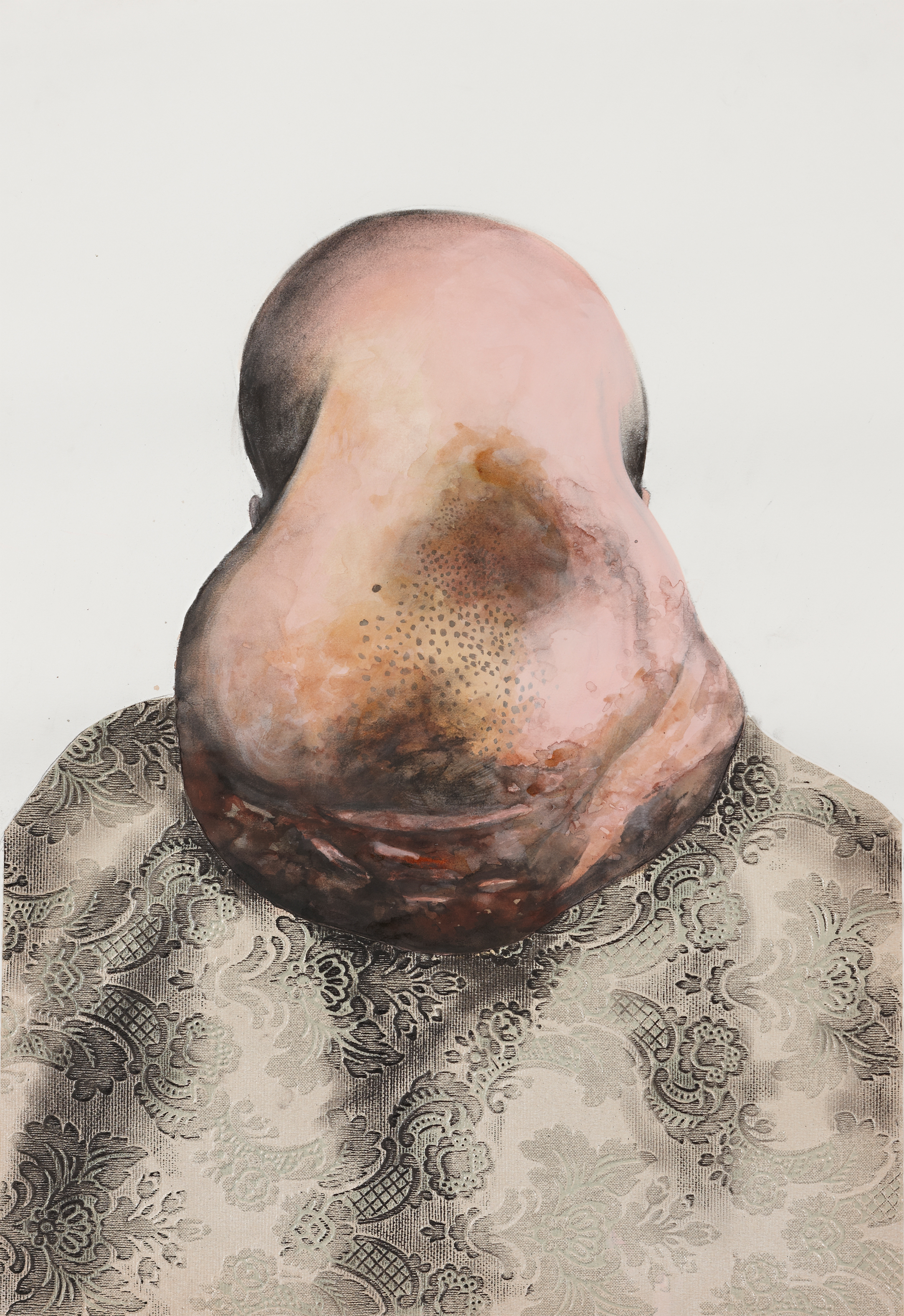 Man with large lump on head