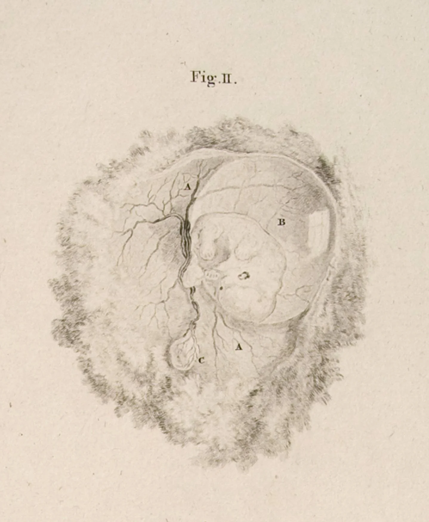 "A Foetus at five weeks."
0
0
1
27
155
University of Michigan
1
1
181
14.0
Normal
0
false
false
false
EN-US
JA
X-NONE
/* Style Definitions */
table.MsoNormalTable
{mso-style-name:"Table Normal";
mso-tstyle-rowband-size:0;
mso-tstyle-colband-size:0;
mso-style-noshow:yes;
mso-style-priority:99;
mso-style-parent:"";
mso-padding-alt:0in 5.4pt 0in 5.4pt;
mso-para-margin:0in;
mso-para-margin-bottom:.0001pt;
mso-pagination:widow-orphan;
font-size:12.0pt;
font-family:Cambria;
mso-ascii-font-family:Cambria;
mso-ascii-theme-font:minor-latin;
mso-hansi-font-family:Cambria;
mso-hansi-theme-font:minor-latin;} William Hunter and Jan van Rymsdyk, Anatomia uteri humani gravidi tabulis illustrata (London, 1774), plate 34.1. Courtesy Special Collections, University of California, Los Angeles.