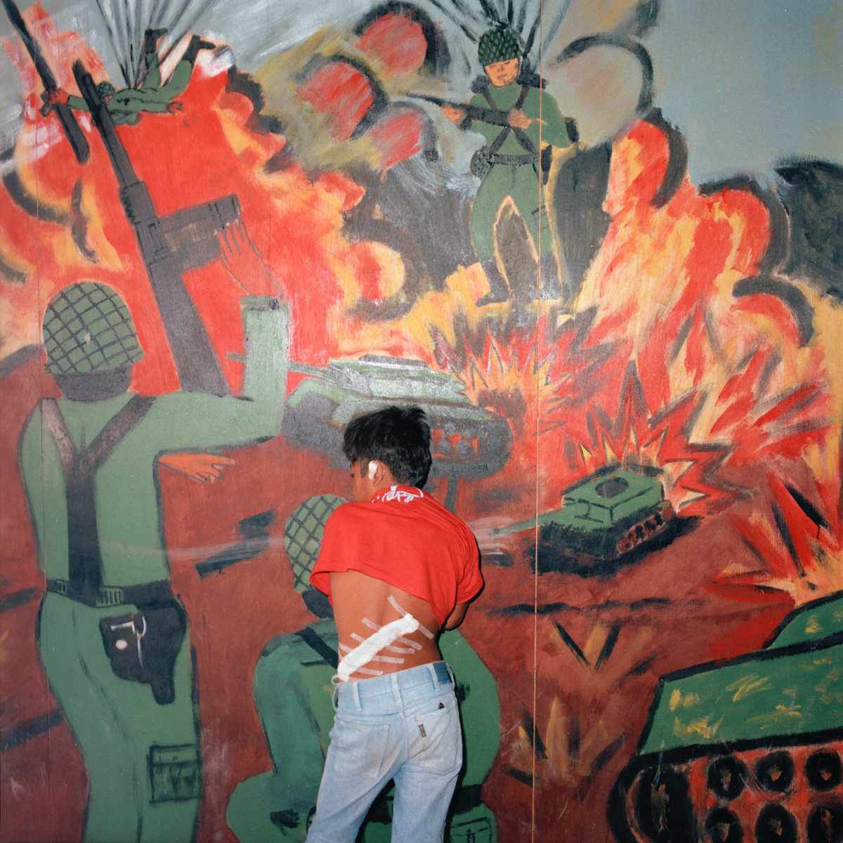 Injured Child, El Salvador 1986