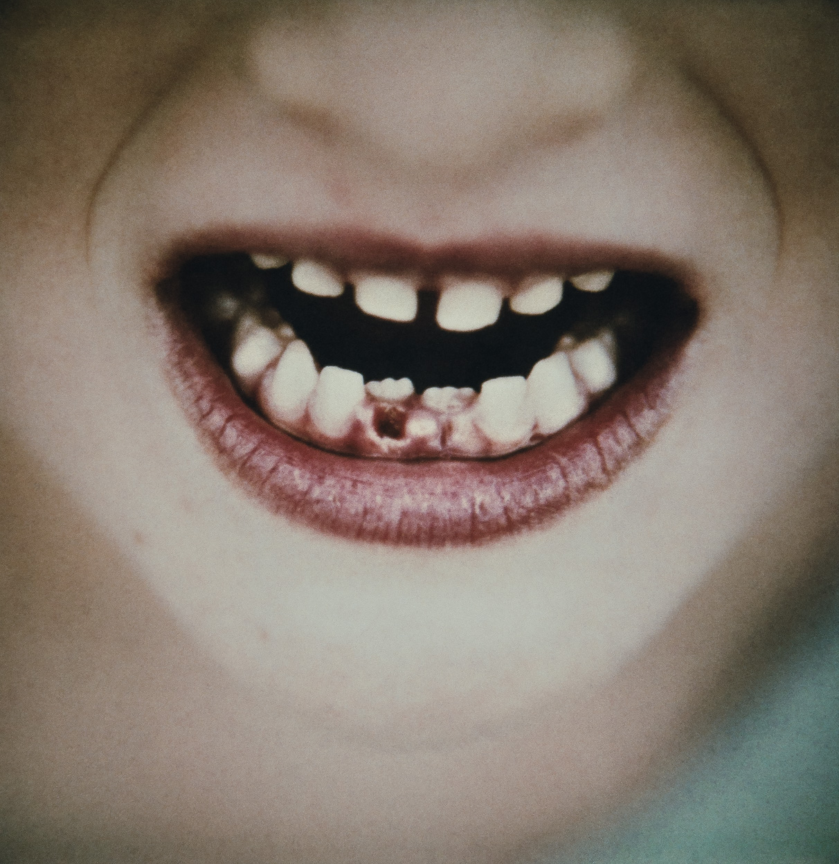 Everybody hurts, sometimes / 2010