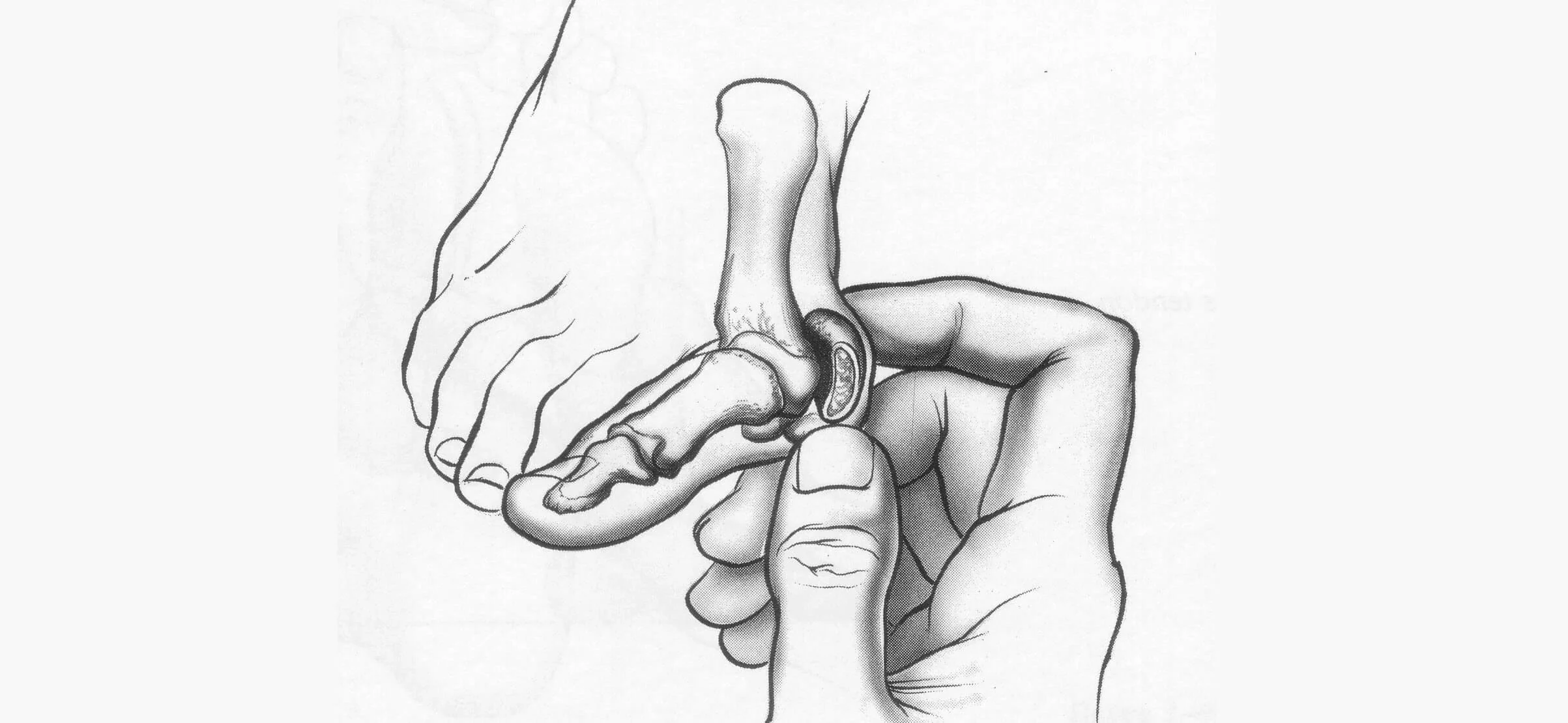 bunion + bursae 2.jpg